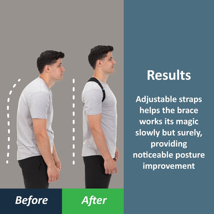 Posture Corrector-Back Brace for Men and Women- Fully Adjustable Straightener for Mid, Upper Spine Support- Neck, Shoulder, Clavicle and Back Pain Relief-Breathable